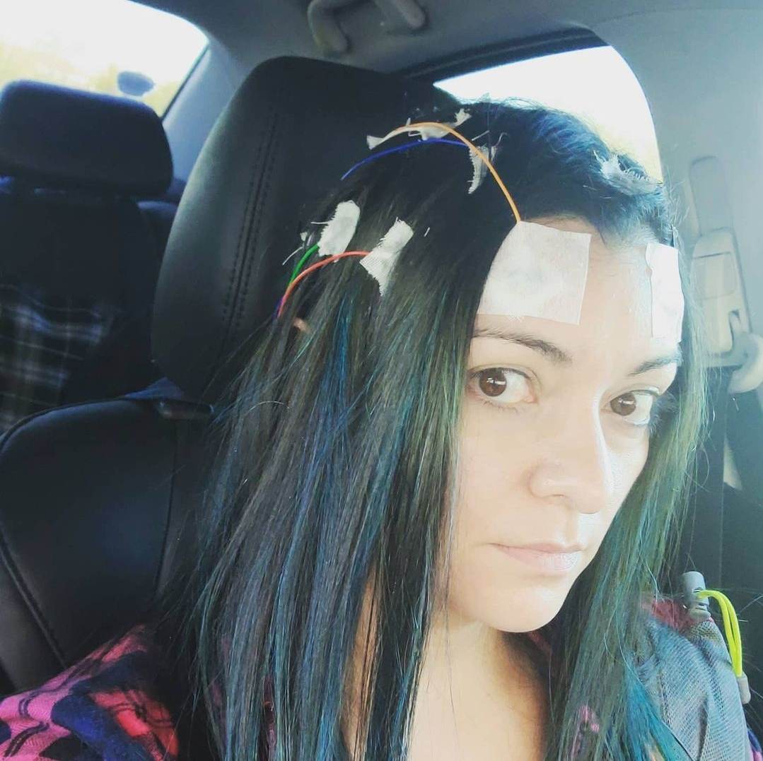 A person with long dark hair sits in a car, wearing electrodes and wires attached to their forehead and scalp with tape, possibly for a medical or neurological test.